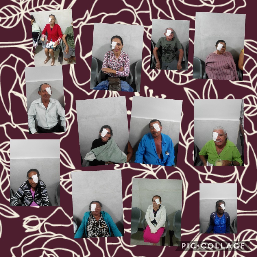 Secretaria de Saúde de Caaporã promove o 8º Mutirão de Catarata.